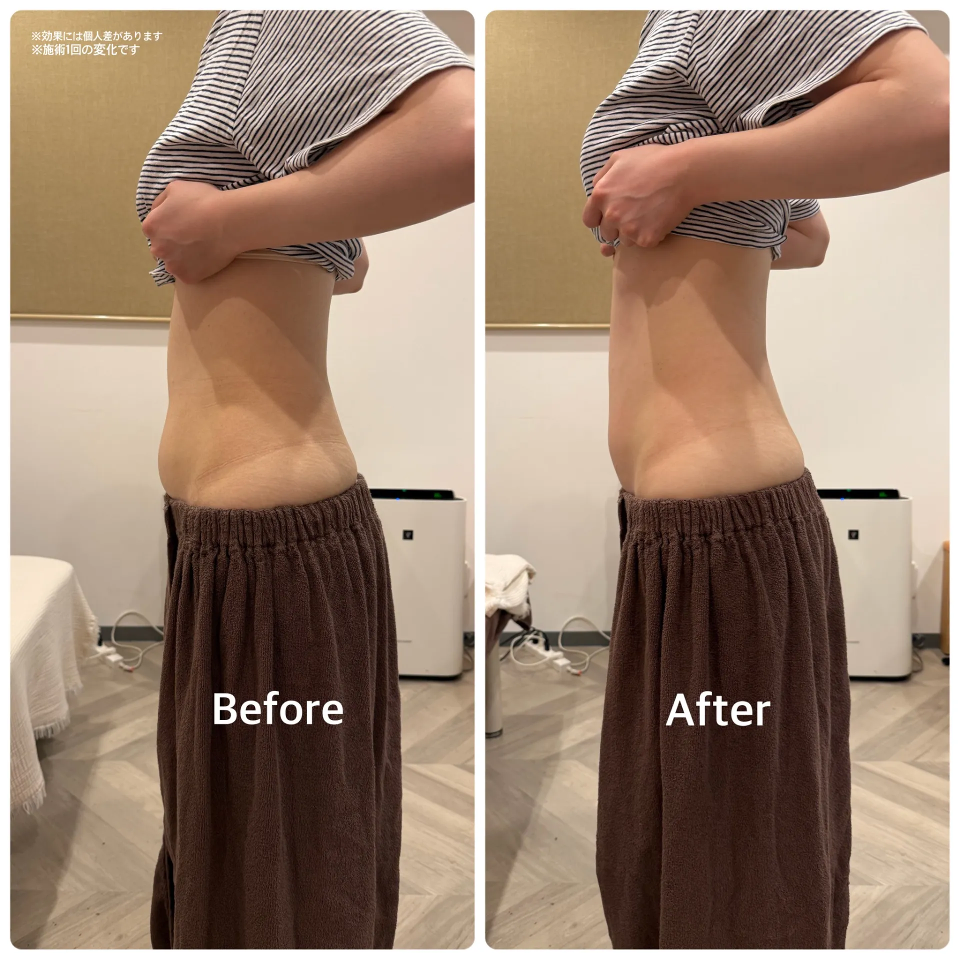 下腹部ぽっこりがスッキリ!